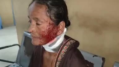 गोगरी: अपराधियों ने सेना के जवान की मां के गले में मारी गोली, पुलिस जांच में जुटी