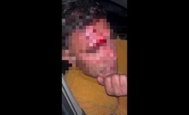 रुद्रप्रयाग: सड़क दुर्घटना में घायल के लिए देवदूत बने संभागीय निरीक्षक चेतन प्रकाश