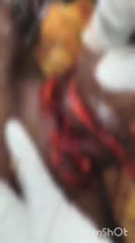 కళ్యాణదుర్గం: బోరంపల్లి గ్రామంలో దారుణం, భార్యను కత్తితో గొంతు కోసి హత్య చేయడానికి ప్రయత్నించిన భర్త