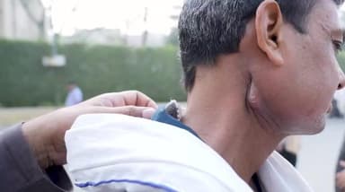 Biopsy Side Effects
82704-82704 #acharyamanishji #hiims