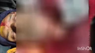 कोटवा: कोटवा के बड़हड़वा कला में बुधवार रात अपराधियों ने एक अधेड़ की गला रेत कर किया घायल, पुलिस जांच में जुटी