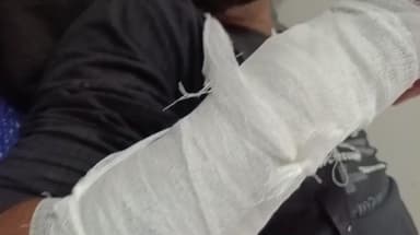 गोटेगांव: सुरवारी के पास सड़क दुर्घटना में बाइक चालक घायल, जिला अस्पताल में भर्ती