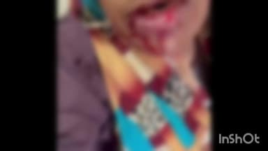 തിരൂര്: കുറുനരിയുടെ കടിയേറ്റ് മൂന്ന് പേർക്ക് ഗുരുതര പരിക്ക്,മലപ്പുറം കരേക്കാട് പാങ്ങ് കോണിക്കൽ ഭാഗത്ത് വെച്ചാണ് ആക്രമണം ഉണ്ടായത്