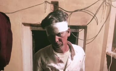 तालबेहट: बिजरौठा के मजरा नोर में दबंगों ने एक युवक के साथ लाठी, डंडा और लात-घुसों से की जमकर मारपीट, 2 नामजद लोगों पर मामला दर्ज