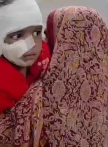 अलवर: कैथवाड़ा गांव में घर के बाहर खेल रही 4 साल की मासूम बच्ची को आवारा कुत्ते ने जख्मी किया, कान, गाल और सिर पर काटा