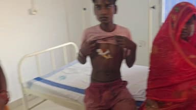 बनमा ईटहरी थाना क्षेत्र में जंगली जानवर का आतंक, चार लोग घायल – इलाके में दहशत #saharsa_bihar #saharsa #सहरसा #सड़क #Saha...