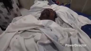 कटिहार: अम्बेडकर कॉलोनी में दो पक्षों के बीच मारपीट, एक व्यक्ति घायल