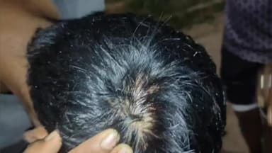 বিশালগড়: দুই পাচারকারী ভাইয়ের হাতে আক্রান্ত অসহায় পরিবারের দুই ছেলে,ঘটনা মধুপুর