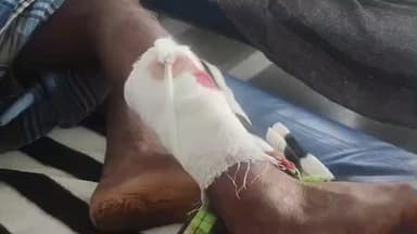 அஞ்செட்டி: லட்சுமிபுரத்தில் ராகி தோட்டத்திற்கு இரவு காவலுக்கு சென்றவரை காட்டுப்பன்றி தாக்கியதில் அவர் ஓசூர் அரசு மருத்துவமனையில் படுதான் எங்களுடன் அனுமதி