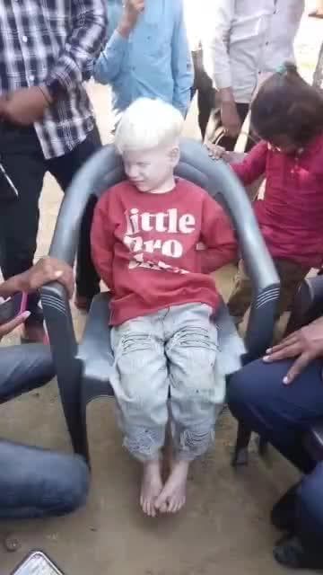 परिहार: मसहा में 9 वर्षीय अद्भुत बालक को देखने उमड़ी भीड़, विदेशी जैसा दिखता है चेहरा