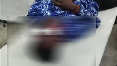 बेंगाबाद: बेंगाबाद में साइकिल का हैंडल खुलने से युवक सड़क पर गिरा, गंभीर रूप से घायल, अस्पताल में इलाज जारी