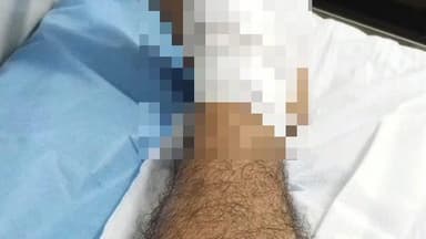 মন্দিরবাজার: বৈদ্যপুর এলাকায় বাইক ও অটো মুখোমুখি সংঘর্ষে আহত আরোহী