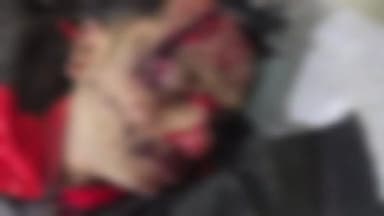 जयसिंहनगर: मोटू ढाबा के पास तेज रफ्तार कार ने बाइक को टक्कर मारी, युवक की मौत और एक घायल