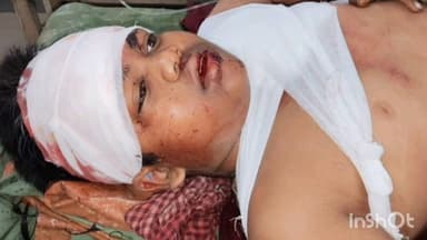 పాతపట్నం: కొరసవాడ రహదారిలో వాటర్ క్యాన్లతోవెళ్తున్న ఆటో బోల్తా, ఓ బాలునికి తీవ్ర గాయాలు