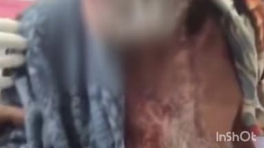 आमेट: झोर गांव में लेपर्ड ने 87 वर्षीय किसान पर किया जानलेवा हमला, आंख नोची और सिर फाड़ा; आधे घंटे तक तड़पता रहा