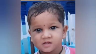 कनवास: दरा में बंदर के हमले से 5 वर्षीय मासूम घायल, दहशत का माहौल, ग्रामीणों ने बंदरों को पकड़कर जंगल में छोड़ने की मांग की