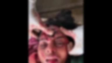 रोहतक: जेएलएन नहर पर युवती को माथे पर मारी गोली, पहचान नहीं हो पाई, इलाके में सनसनी