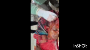 शंकरगढ़: शंकरगढ़ वन परिक्षेत्र अंतर्गत अमरठा गांव में भालू ने महिला पर किया हमला, प्राथमिक उपचार के बाद अंबिकापुर रेफर