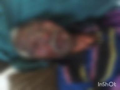 चिमूर: विद्युत प्रवाहाच्या शार्क सर्किटमुळेत धनाच्या पुंज ण्यासह शेतकरी जळाले