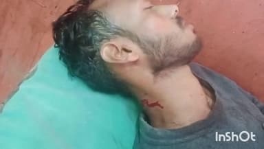 हरदोई: शहर के पीताम्बर गंज में युवक पर चाकू से हमला, गंभीर हालत में जिला अस्पताल में भर्ती, पुलिस जांच में जुटी