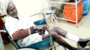 ಶಹಾಬಾದ: ಜೆ.ಪಿ ನಗರದಲ್ಲಿ ವಯೋವೃದ್ಧನ ಮೇಲೆ ಬೀದಿ ನಾಯಿಗಳ ದಾಳಿ