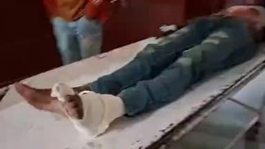 मुरादाबाद: भगतपुर थाना क्षेत्र में मनबुद्धि लड़की ने छत पर खड़े युवक को धक्का देकर घायल किया, इलाज के लिए अस्पताल में भर्ती