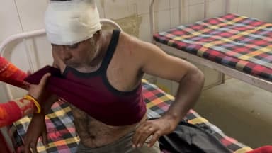 बकानी: सलावद में जमीनी विवाद को लेकर खुनी संघर्ष, धारदार हथियार से किया व्यक्ति को घायल