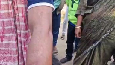 ଜଳେଶ୍ବର: ବାଲି ଉତ୍ତୋଳନକୁ ବିରୋଧ କରିବାରୁ ୨ ଗୋଷ୍ଠୀ ମଧ୍ଯରେ ଗଣ୍ତଗୋଳ,ତେଲେଙ୍ଗା କଟୁରୀ ଓ ବିଭିନ୍ନ ମାରଣାସ୍ତ୍ରରେ ଆକ୍ରମଣ,ଜଣେ ଗୁରୁତର,ଗିଲାଯୋଡିରେ