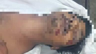 कळमनूरी: आ.बाळापुर शहरानजीक इरिगेशन कॅम्प जवळ ऑटो पलटी होऊन चालकाचा मृत्यू