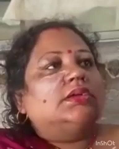 भाटपार रानी: देवरिया-गोरखपुर मार्ग पर हुई दुर्घटना में महिला घायल, पति बाल-बाल बचे