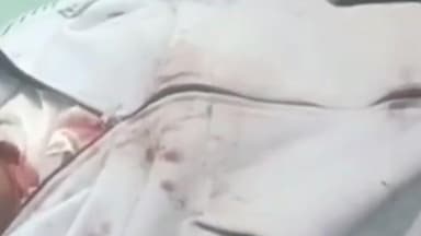 देेवगढ़: काछबली में भालू के अटैक से दहशत, घायल ग्रामीण को जिला अस्पताल किया रेफर