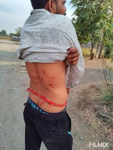 नायगाव-खैरगाव: कृष्णुर औद्योगिक वसाहत परिसरात बिबट्याने एका व्यक्तीवर केला हल्ला, जखमीचे फोटो समाजमाध्यमावर व्हायरल