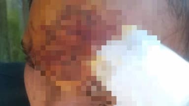 ডায়মন্ডহারবার ২: নুরপুর এলাকায় বাইক ও মোটর ভ্যান এর সংঘর্ষে আহত বাইক আরোহী