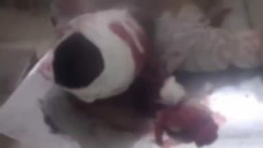 పుంగనూరు: భారత్ పెట్రోల్ బంక్ సమీపంలో రెండు ద్విచక్ర వాహనాలు ఢీకొని ఓ వ్యక్తి పరిస్థితి విషమం. ల