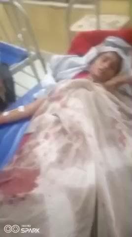 माधौगढ़: नगर में बच्चों के विवाद में एक महिला घायल, अस्पताल में भर्ती, पुलिस जांच में जुटी