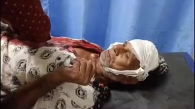 हुसैनगंज: हुसैनगंज थाना क्षेत्र के शाहबाजपुर गांव में आपसी विवाद में पाटीदारों ने दो लोगों से मारपीट की, दोनों घायल