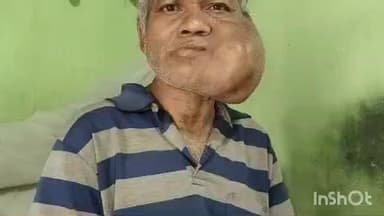 ଜି ଉଦୟଗିରି: ସତର ବର୍ଷ ଧରି ଜୀବନ ସହ ସଂଘର୍ଷ  କରୁଛନ୍ତି ନିଲିଙ୍ଗିଆ ଏସୀଅ ନାୟକ,ସରକାରୀ ସହାୟତା ପାଇଁ  ଲୋକେ କଲେ ଦାବୀ # jansamaya