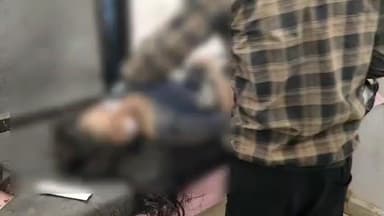 हनुमना: शाहपुर के पहाड़ी गांव में पति ने पत्नी से की मारपीट, खौलती कड़ाही में गिरने से महिला गंभीर