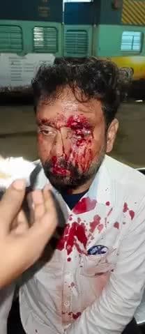 पलामू एक्सप्रेस 13348 ट्रेन से गिरने से सीनियर टीम गार्ड घायल बरवाडी रेलवे स्टेशन पर घटना हुआ