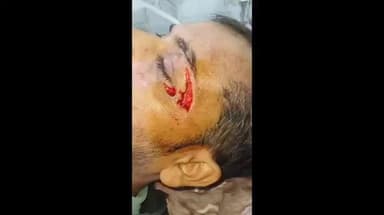 हमीरपुर: सुमेरपुर में पुलिस ने शिकायत पर कार्रवाई नहीं की, जिसके बाद हुआ हमला