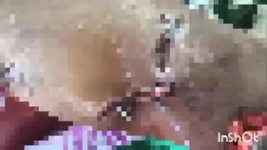 पवनी: अस्वलाच्या हल्ल्यानंतर ग्रामस्थांचा संताप उफाळला; वनविभागाच्या दिरंगाईवर प्रश्नचिन्ह