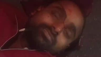 सोहावल: ड्योढ़ी - रौनाहीं संपर्क मार्ग पर भीषण सड़क दुर्घटना, घायल को गंभीर हालत में जिला अस्पताल भेजा गया