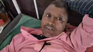 बिल्सी: बिल्सी में दो बाइकों के बीच हुई जोरदार भिड़ंत, पुलिस ने घायलों को अस्पताल पहुंचाया