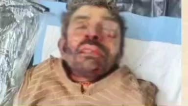 पडरौना: कुशीनगर में सनसनी: कटाई भरपुरवा गाँव के काली मंदिर के पास अर्धनग्न अवस्था में अज्ञात व्यक्ति का शव बरामद, शिनाख्त जारी