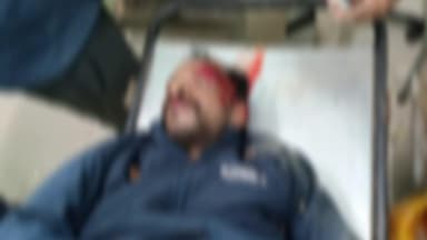 মেমারি ১: মেমারিতে মর্মান্তিক বাইক দুর্ঘটনায় গুরুতর আহত এক ব্যক্তি