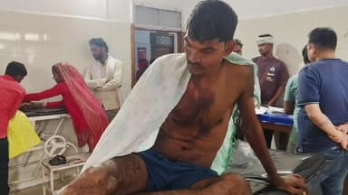 खरगापुर: फुटेर: दो बैल आपस में लड़े, ठेले से टकराए, दुकानदार घायल, ज़िला अस्पताल में भर्ती