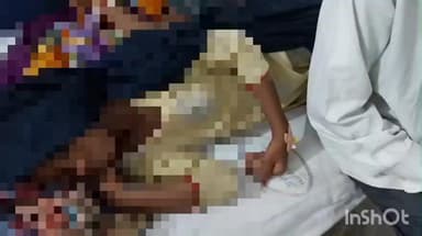 वारिसलीगंज: बाघी बरडीहा स्टेशन के पास अज्ञात गाड़ी की चपेट में आने से एक बच्ची जख्मी