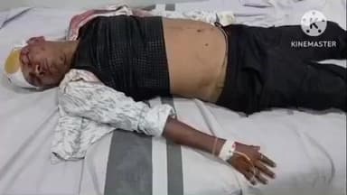 ସିମୁଳିଆ: ଶାରୀଶୁଆ ଘାଟି ରେ ଭାରସାମ୍ୟ ହରାଇ ସ୍କୁଟି ରୁ ପଡି 3 ଜଣ ଗୁରୁତର ଅବସ୍ଥା ରେ ମେଡିକାଲ ରେ ଭର୍ତ୍ତି