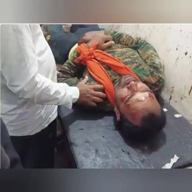 सिकंदरपुर: करमौता पावर हाउस के समीप बाइक के धक्के से 35 वर्षीय युवक गंभीर रूप से घायल