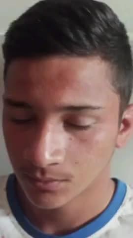 पूर्णागिरि: गांव से नगर में दूध देने आए किशोर पर ततैयों ने किया हमला, घायल